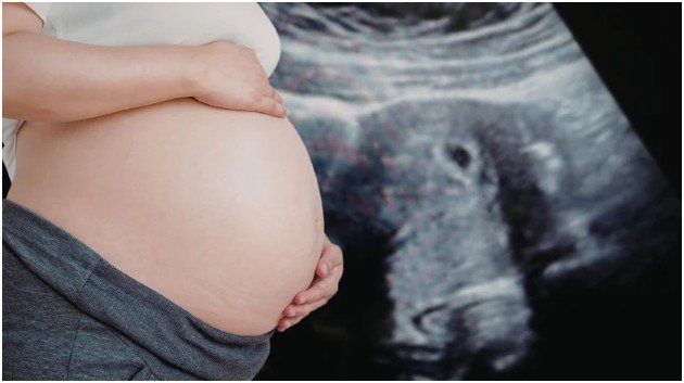 When Should You Have a Dating Scan?